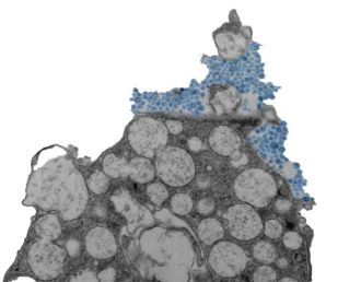 Human nasal epithelial cell releasing rhinovirus (blue)