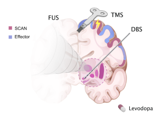 SCAN-targeted therapies for Parkinson's Disease (PD)
