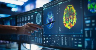 Preliminary results from a first of its kind study at Adelaide University suggest that changes in the brain following a traumatic brain injury (TBI), such as a concussion, may continue for many years after the injury, even in healthy adults.