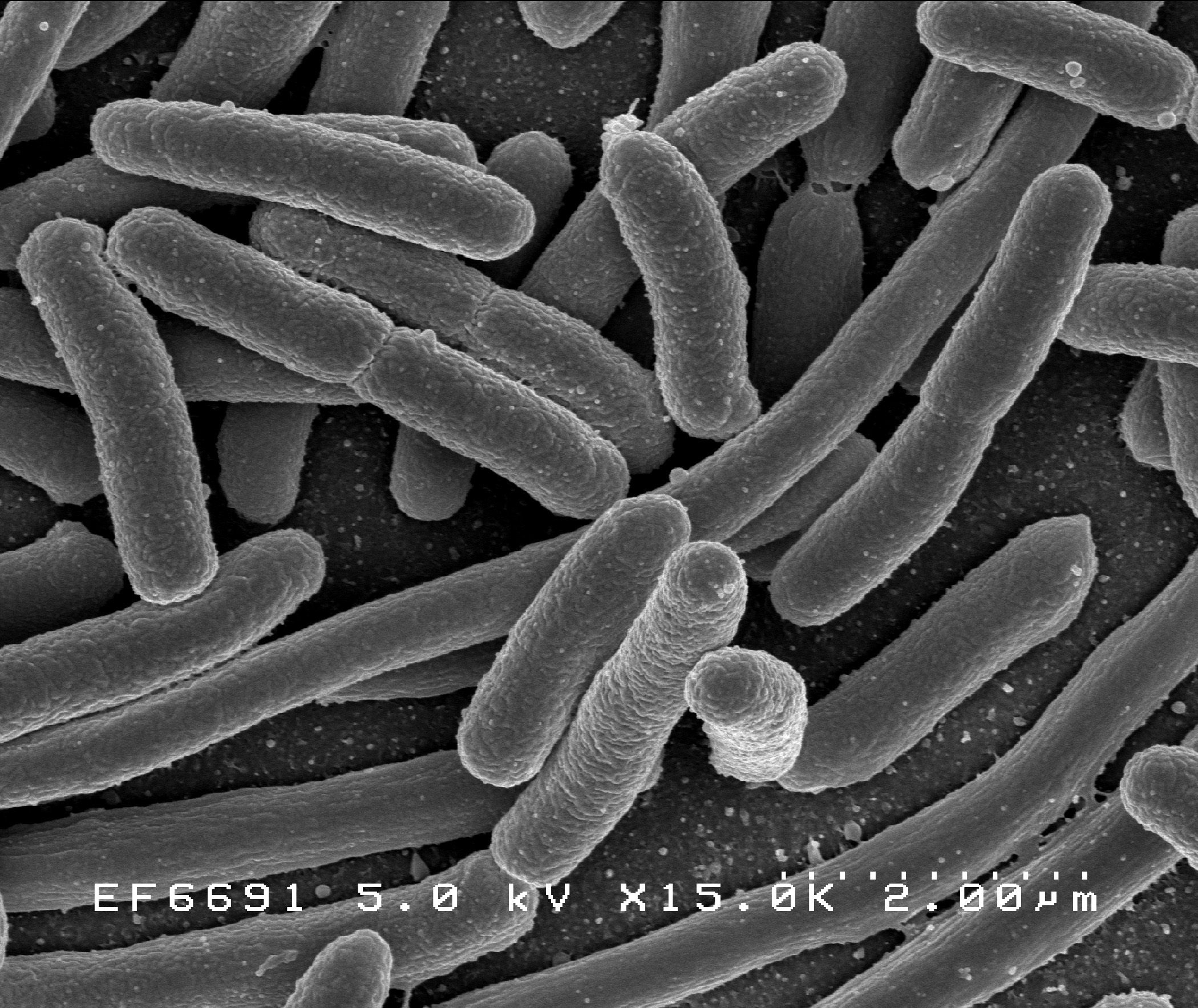 By NIAID - E. coli Bacteria, Public Domain, https://commons.wikimedia.org/w/index.php?curid=39933215