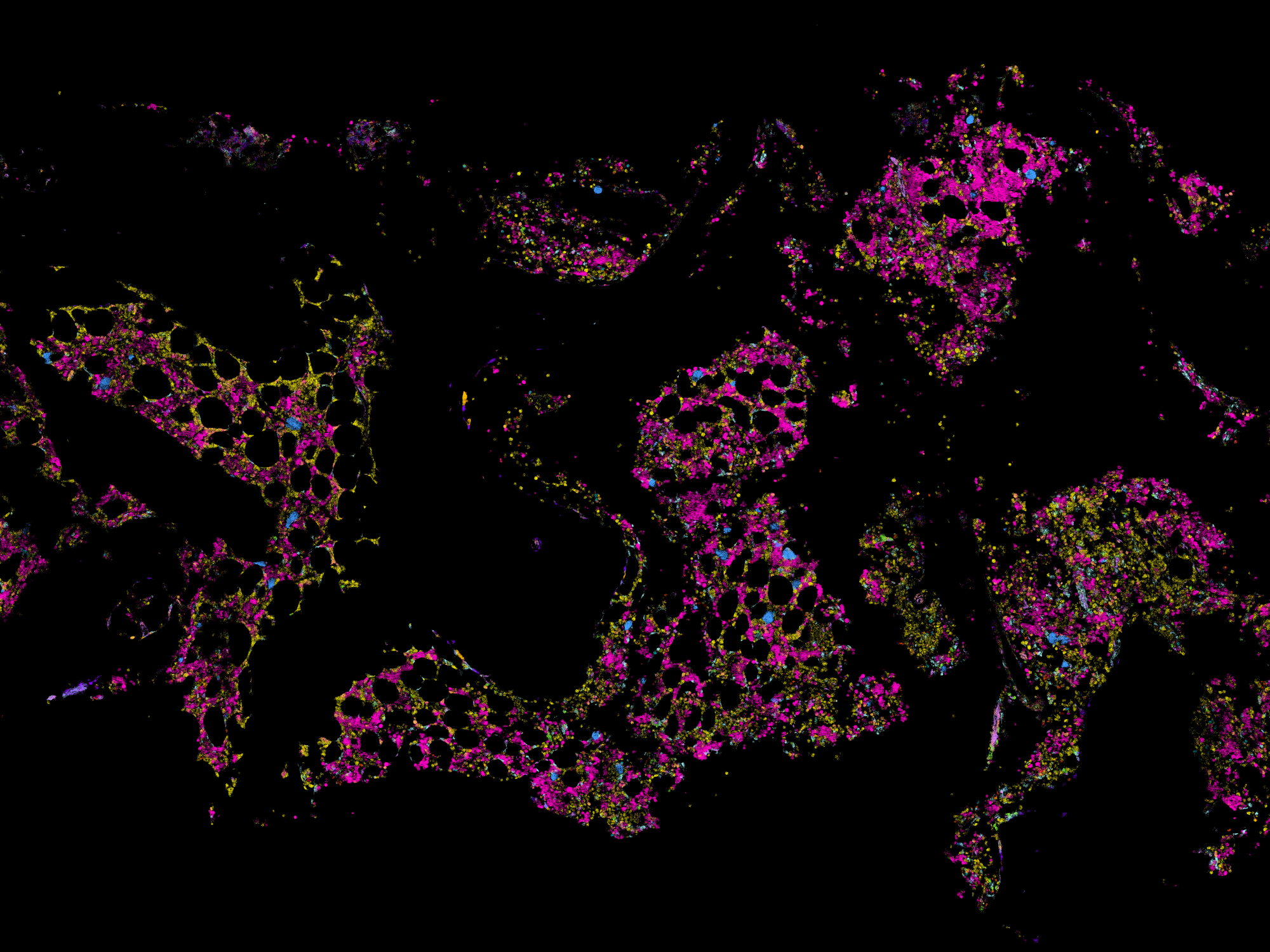 The first detailed molecular map of human bone marrow, created by WEHI researchers using state-of-the-art spatial technology, with each colour representing a different cell type. Credit: WEHI