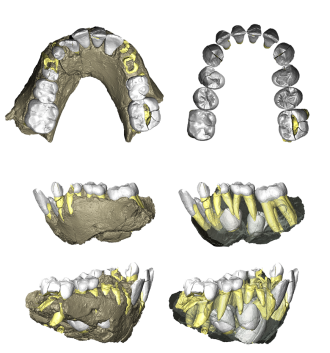 3D renderings of the juvenile mandible