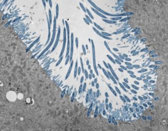Human nasal organoids with cilia