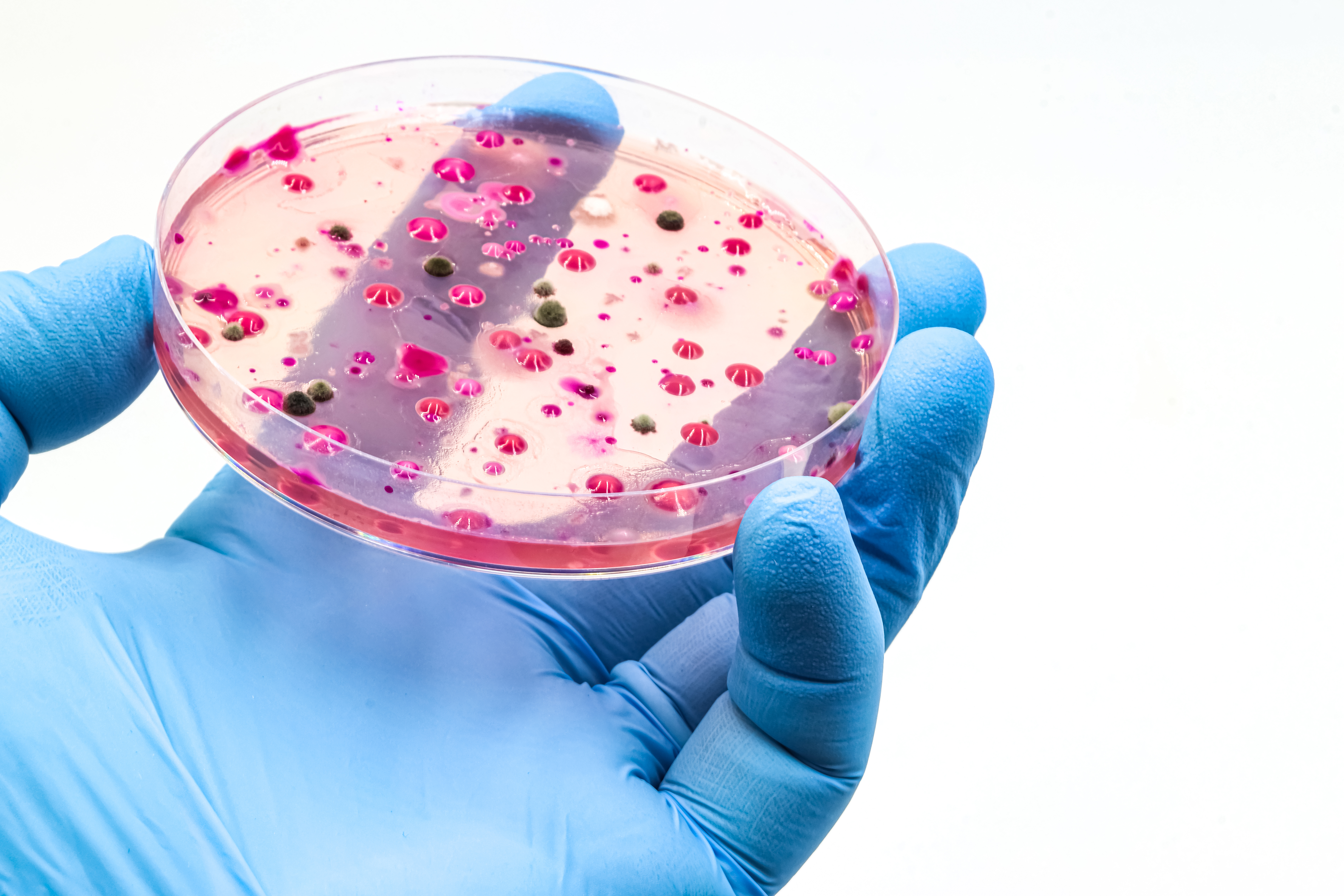 TopMicrobialStock via Getty Images