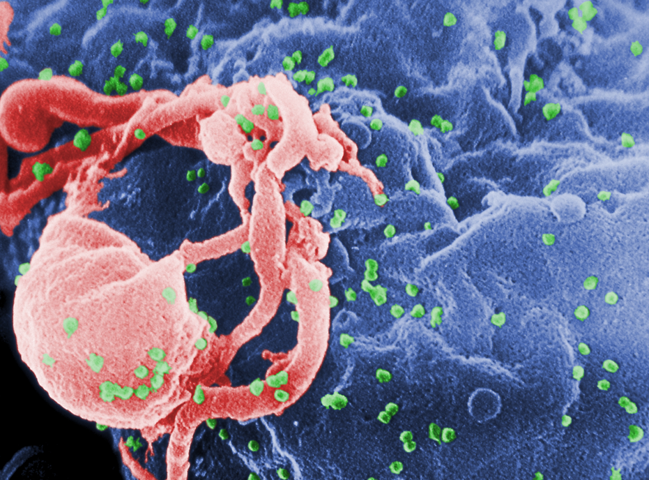 HIV budding off a lymphocyte