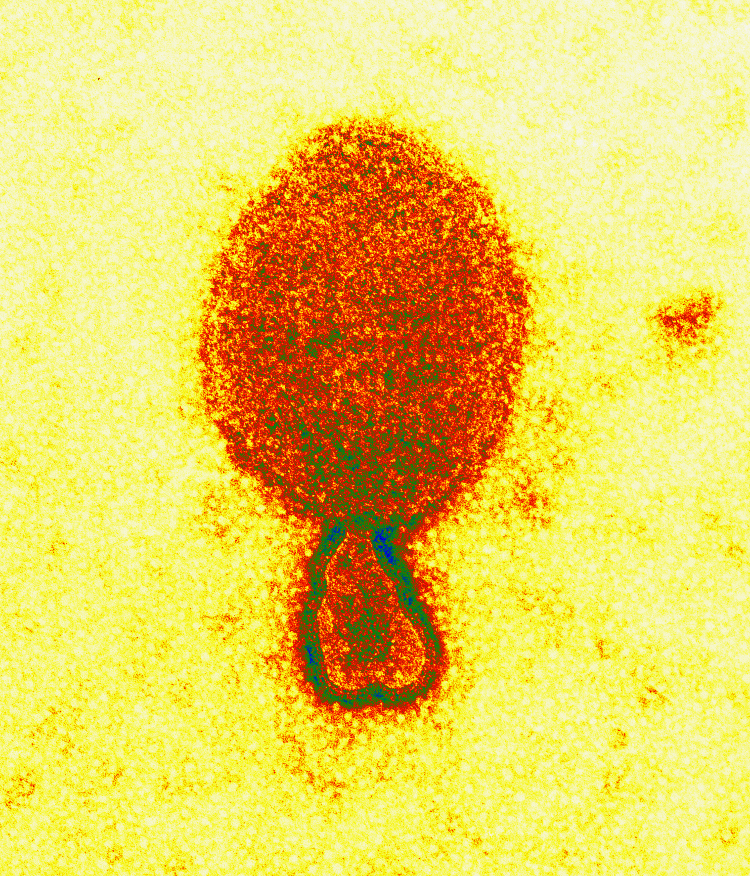 Hendra virus which is also a hanipavirus - Credit: Electron Microscopy Unit, Australian Animal Health Laboratory, CSIRO