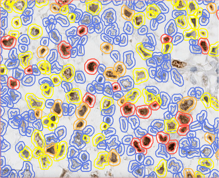 https://commons.wikimedia.org/wiki/File:Ki67_calculation_by_QuPath_in_a_pure_seminoma.png