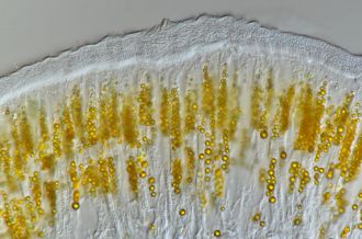 Microscopy analysis of the yellow granules.