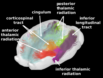 Top view of the Turone equine brain fibre atlas obtained using diffusion imaging