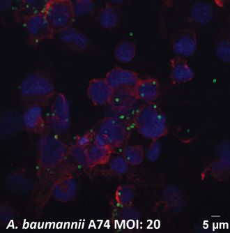 Immunofluoresence microscopy of A. baumannii bacteria.