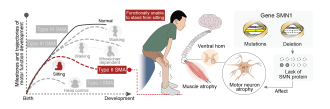 SMA Pathophysiology