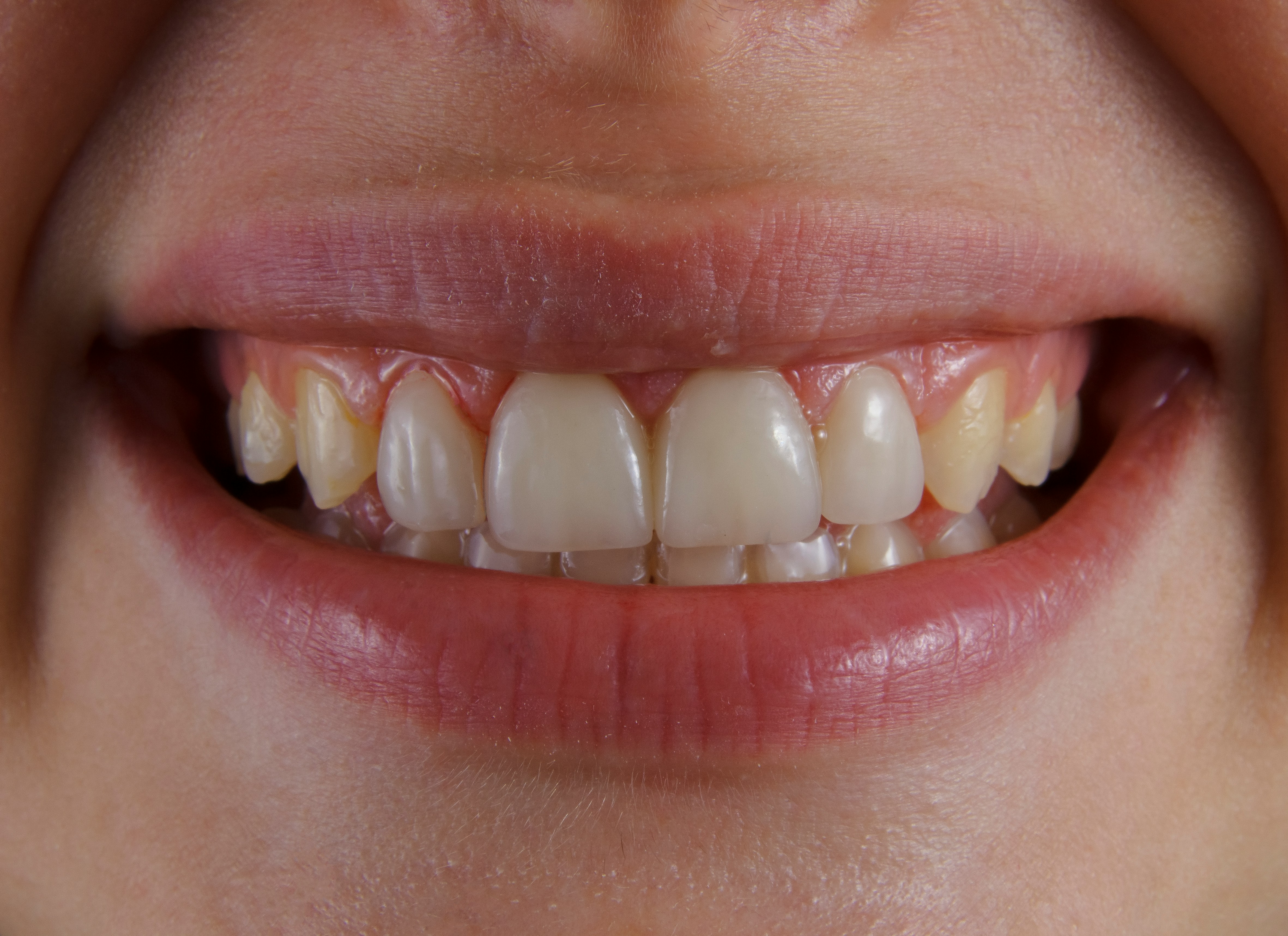 Photo by Ozkan Guner on Unsplash
