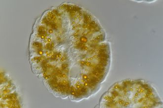 Microscopy analysis of the yellow granules.