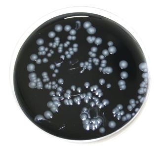 Legionella 