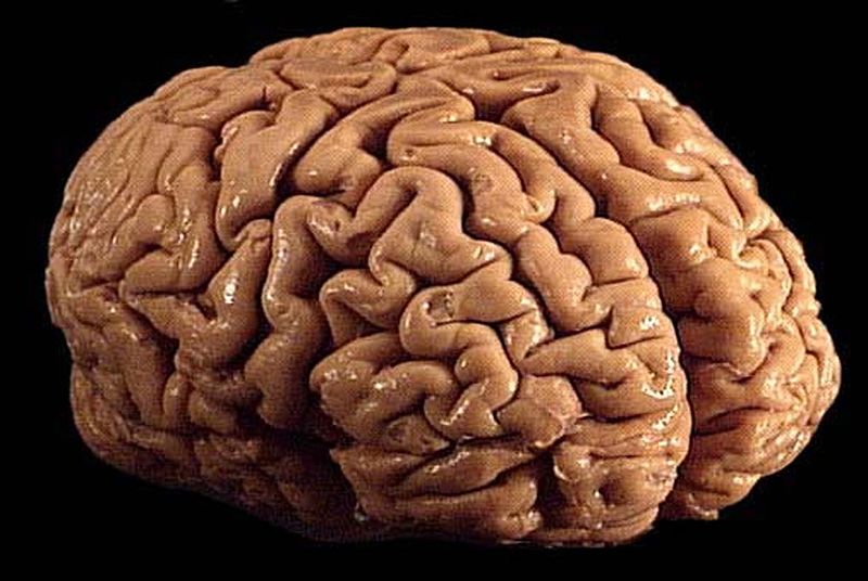 Brain credit Allan Ajifo, via Wikimedia Commons