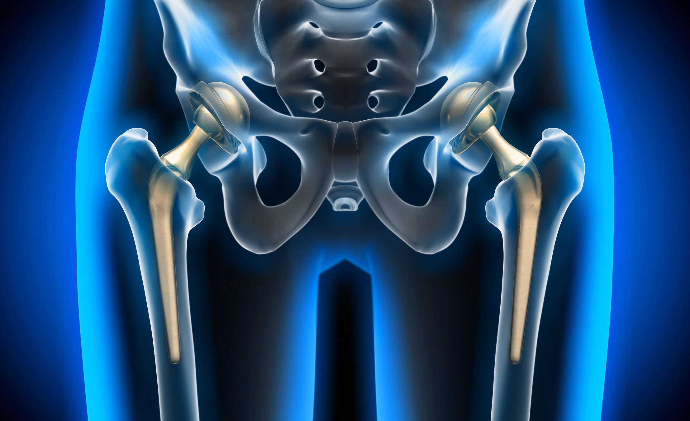 Potential new way to save infected hip replacement implants Scimex