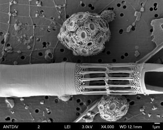 The spherical organisms are a type of haptophyte called coccolithophorids