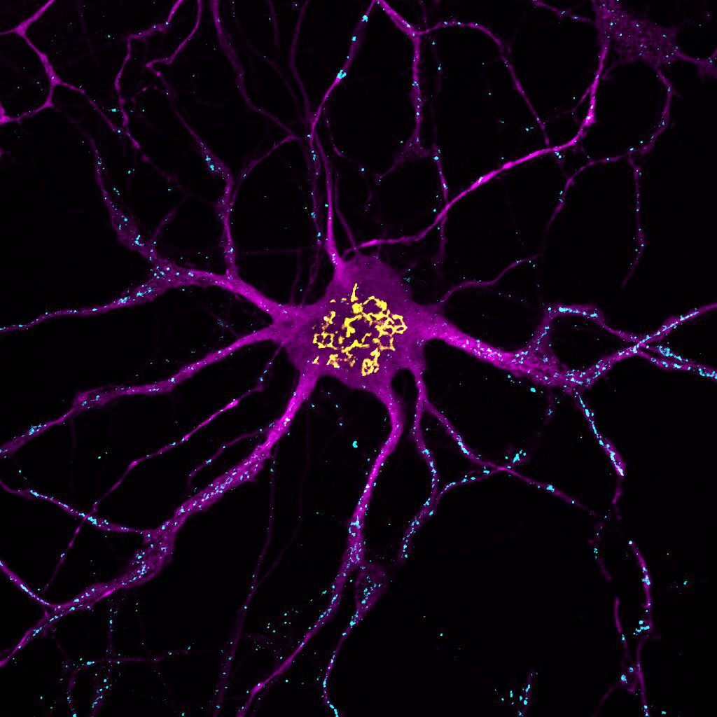 Hippocampal neurons (magenta), labelled for DDHD2 (cyan) and endomembranes (yellow). Photo by UQ