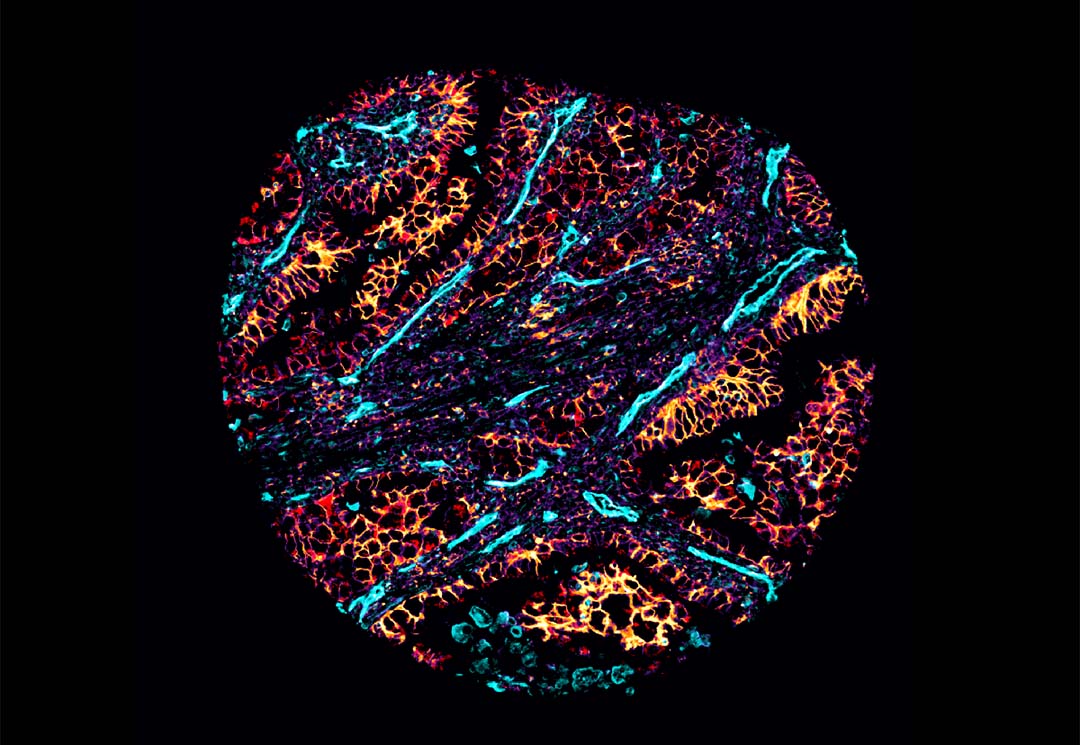 The University of Queensland