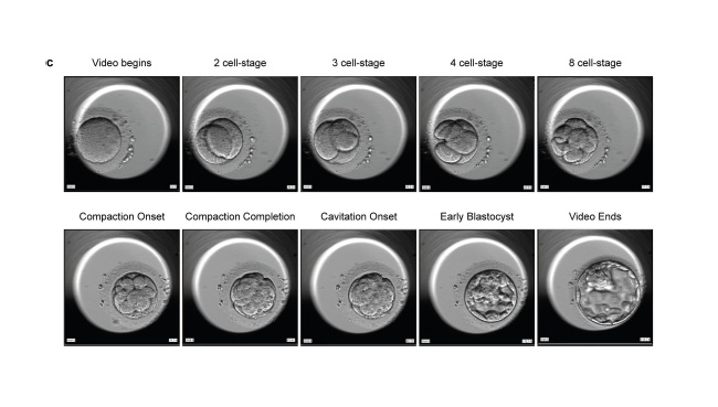 Figure 1. Overview of study to detect sex differences from embryoscope movies. (c) Depiction of the different time points used during manual annotation, with corresponding embryoscope snapshot. CREDIT: Liang, et al. (2026)