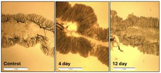 Example of M4 crypts of adults. 