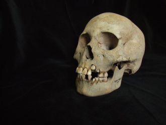 The skull of a 9-11 year old girl