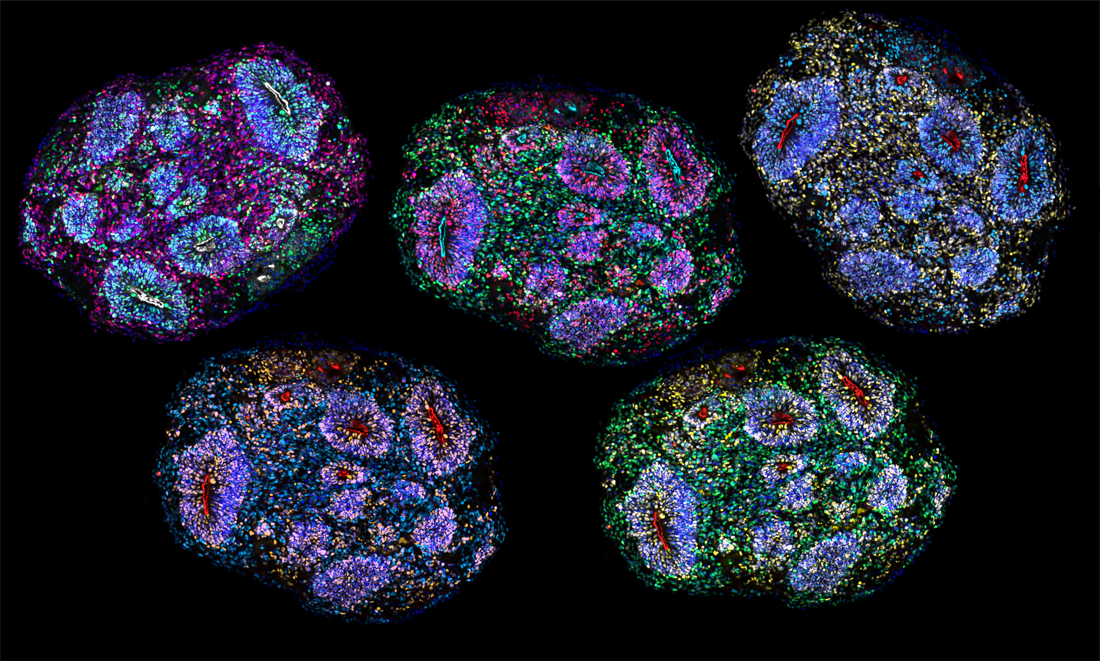 A composite mosaic of sections of an organoid immunolabelled for different cell type markers. Credit: Irene Faravelli and Noelia Antón-Bolaños