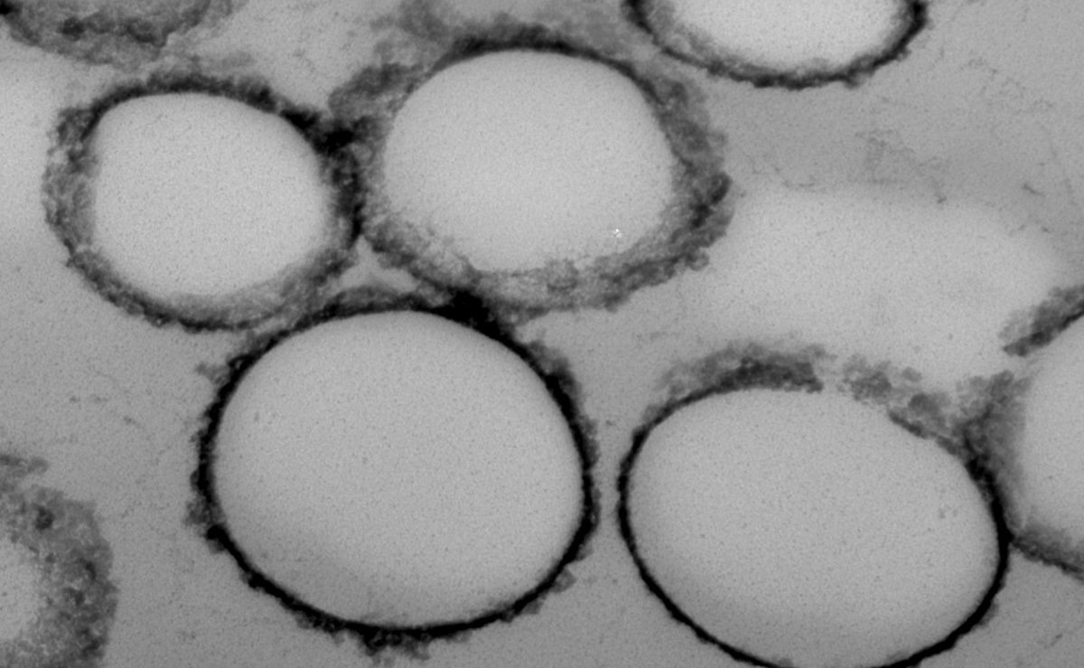 Electron microscopy image of polymer nanobeads 