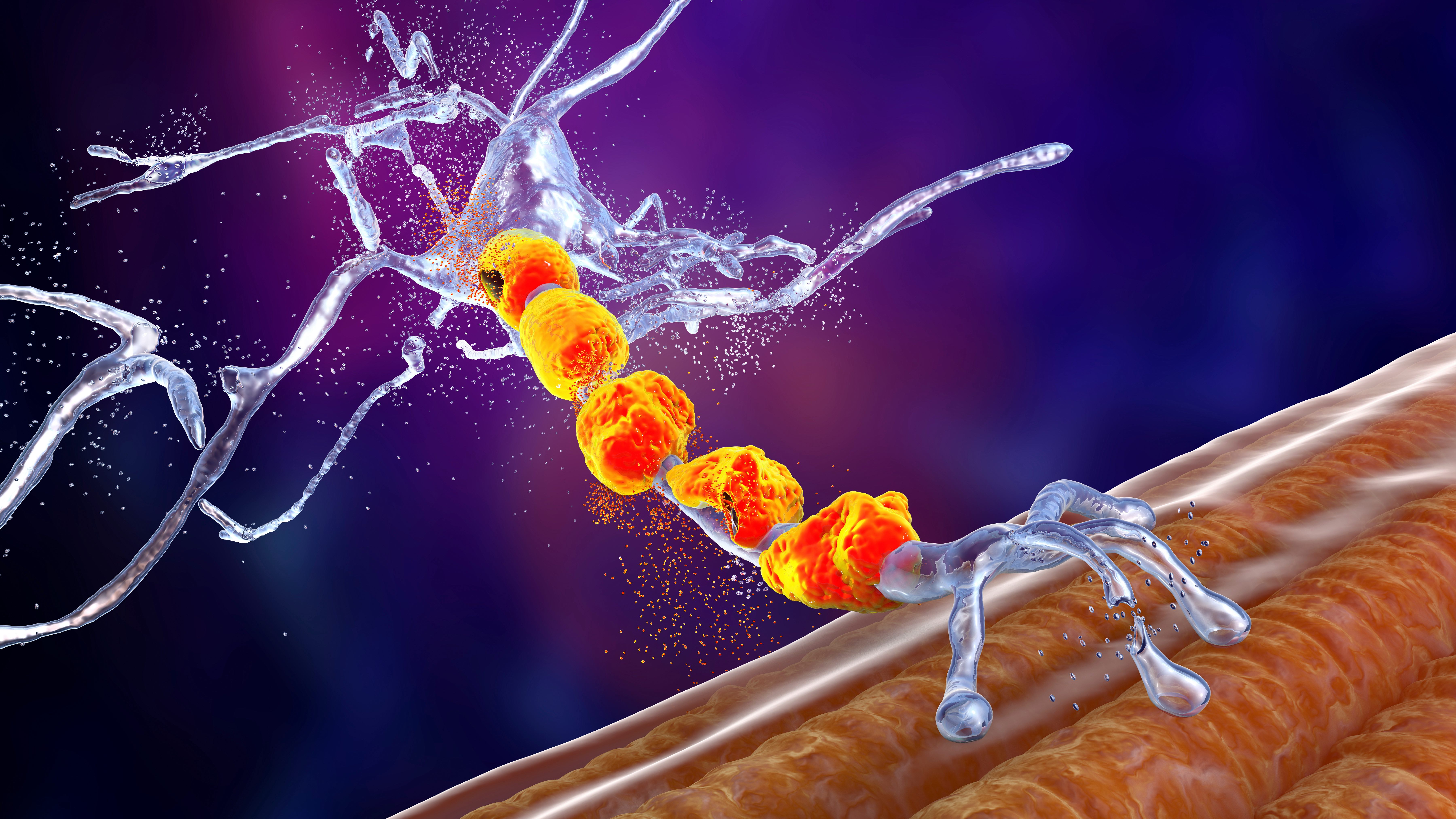 A graphic depicting the degeneration of a motor neuron. Image: Adobe
