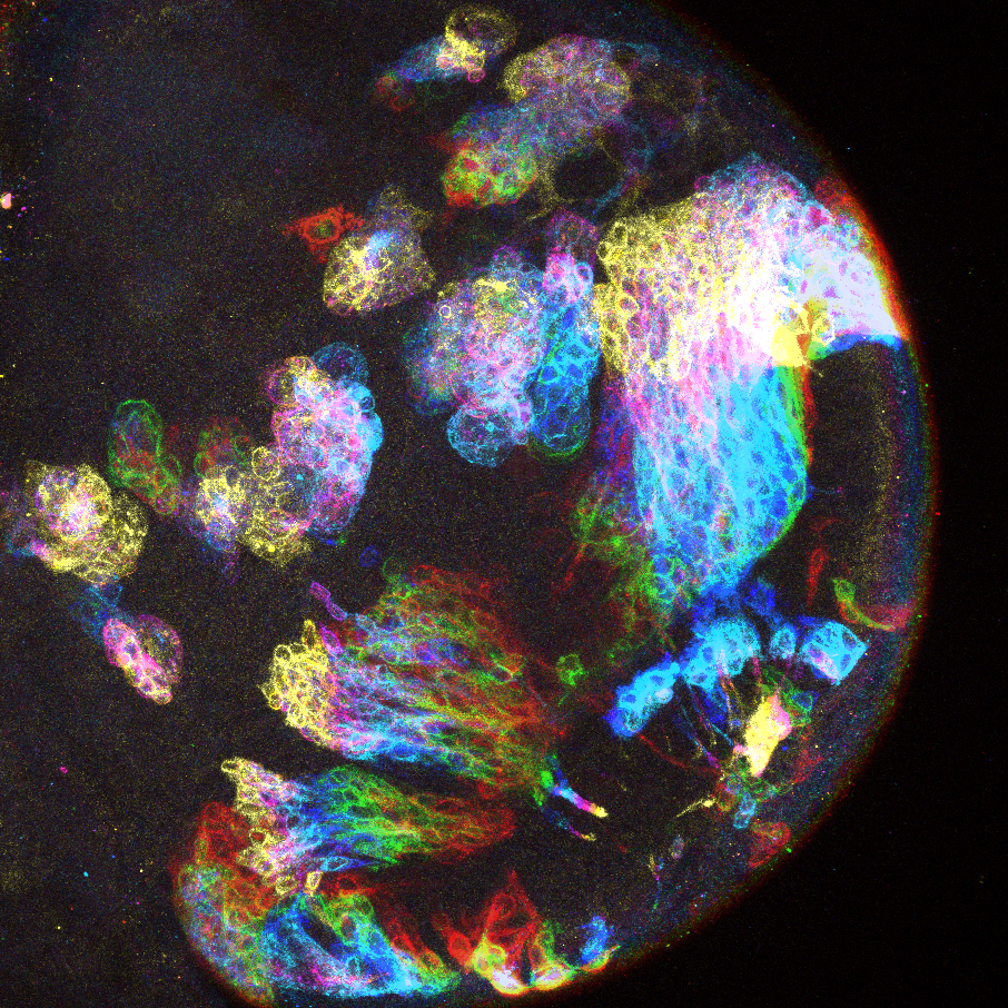 Fly Brain Imaging Courtesy of Prof Louise Cheng