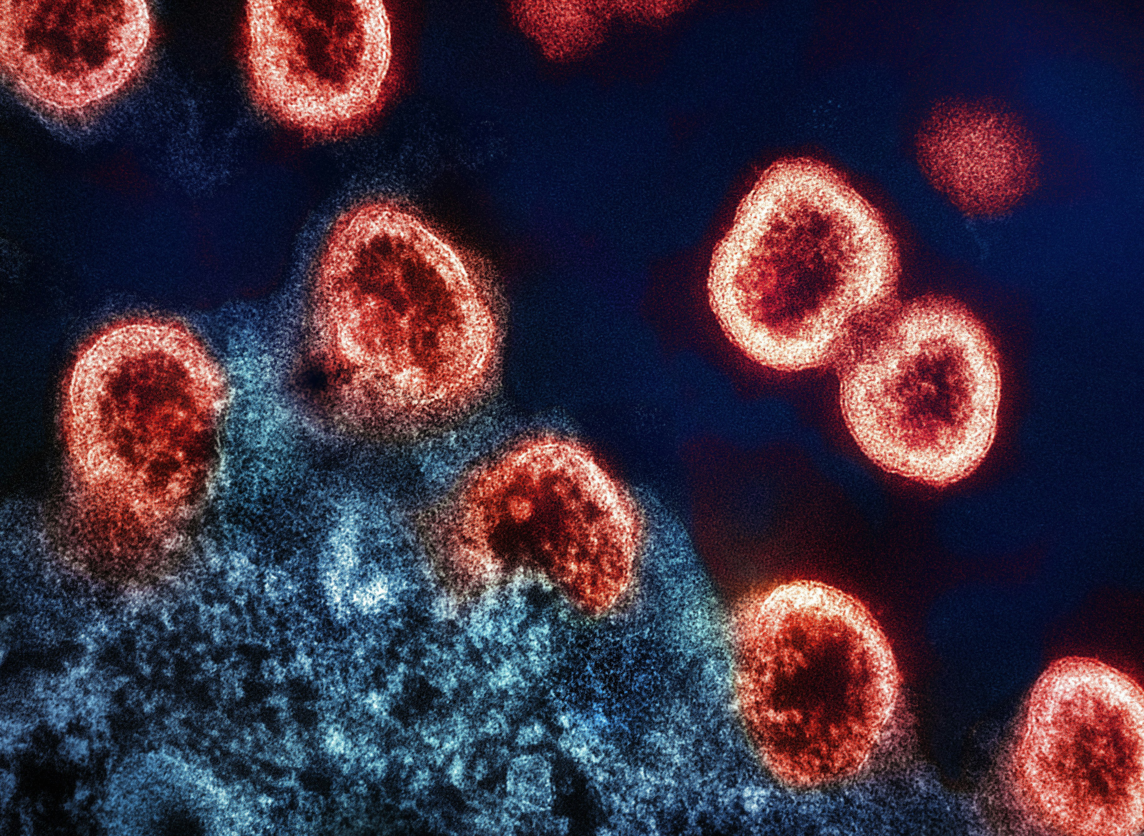 HIV-1 Virus Particles Transmission electron micrograph of HIV-1 virus particles (colorized red) replicating from an HIV-infected H9 T-cell (blue). Image captured at the NIAID Integrated Research Facility (IRF) in Fort Detrick, Maryland. Photo by National Institute of Allergy and Infectious Diseases on Unsplash