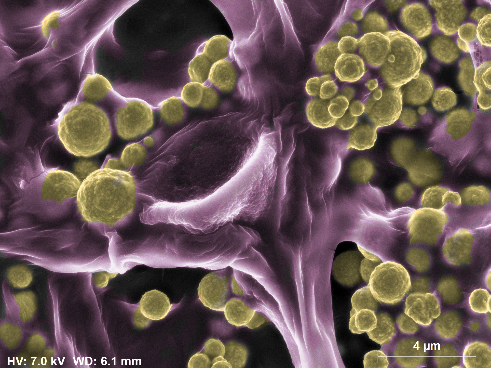 Coloured SEM image of the gold-coated Fusarium oxysporium fungi. Credit CSIRO