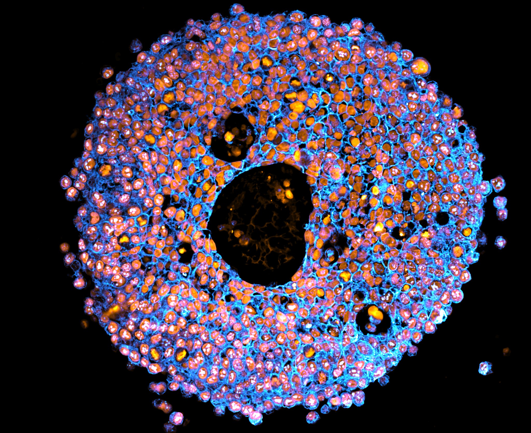 Microscope image of placenta organoid (mini placenta). Images acquired at the UTS Microbial Imaging Facility by Dr Claire Richards.