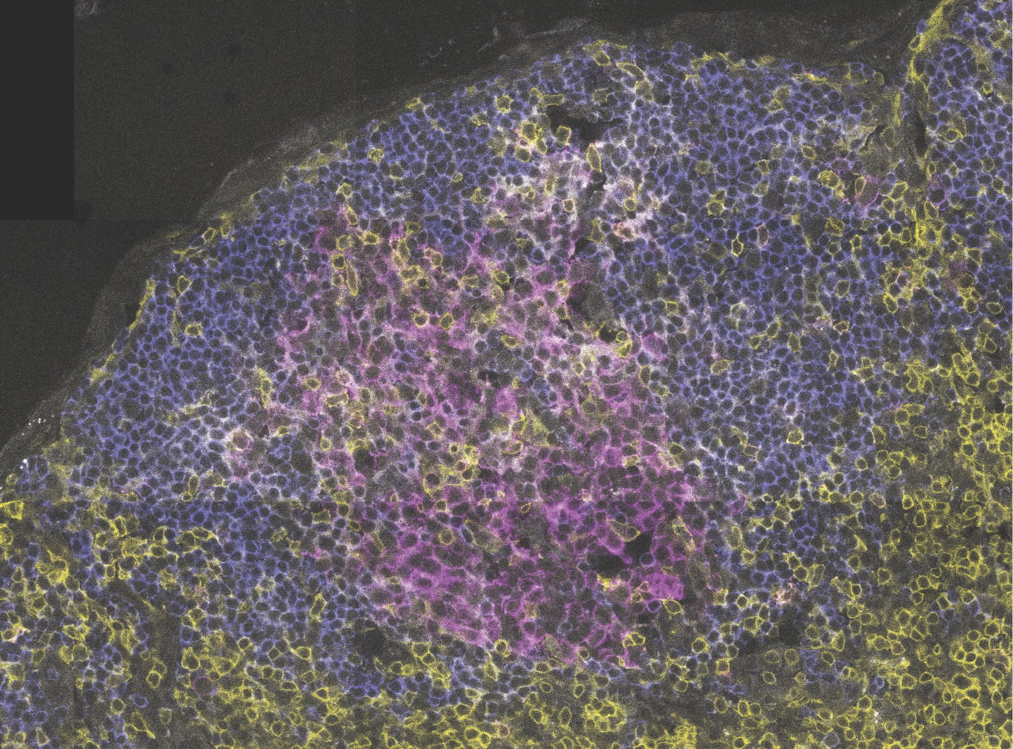 Yellow T follicular helper (Tfh) cells activate magenta B cells to help produce protective antibodies in a mouse lymph node during parasite infection. WEHI-led research has revealed how Tfh cells adapt their signals depending on the infection type, paving the way for better vaccines. Credit: WEHI