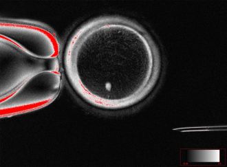 Human egg made from skin cell