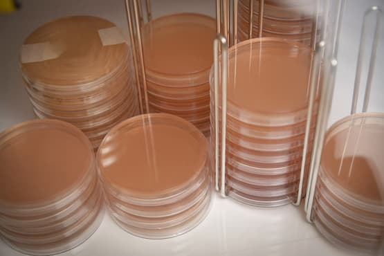 Agar plates used to grow bacteria from the human gastrointestinal tract. Source: Monash University