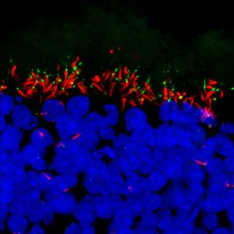 Retinal organoid photoreceptors RPGRIP1