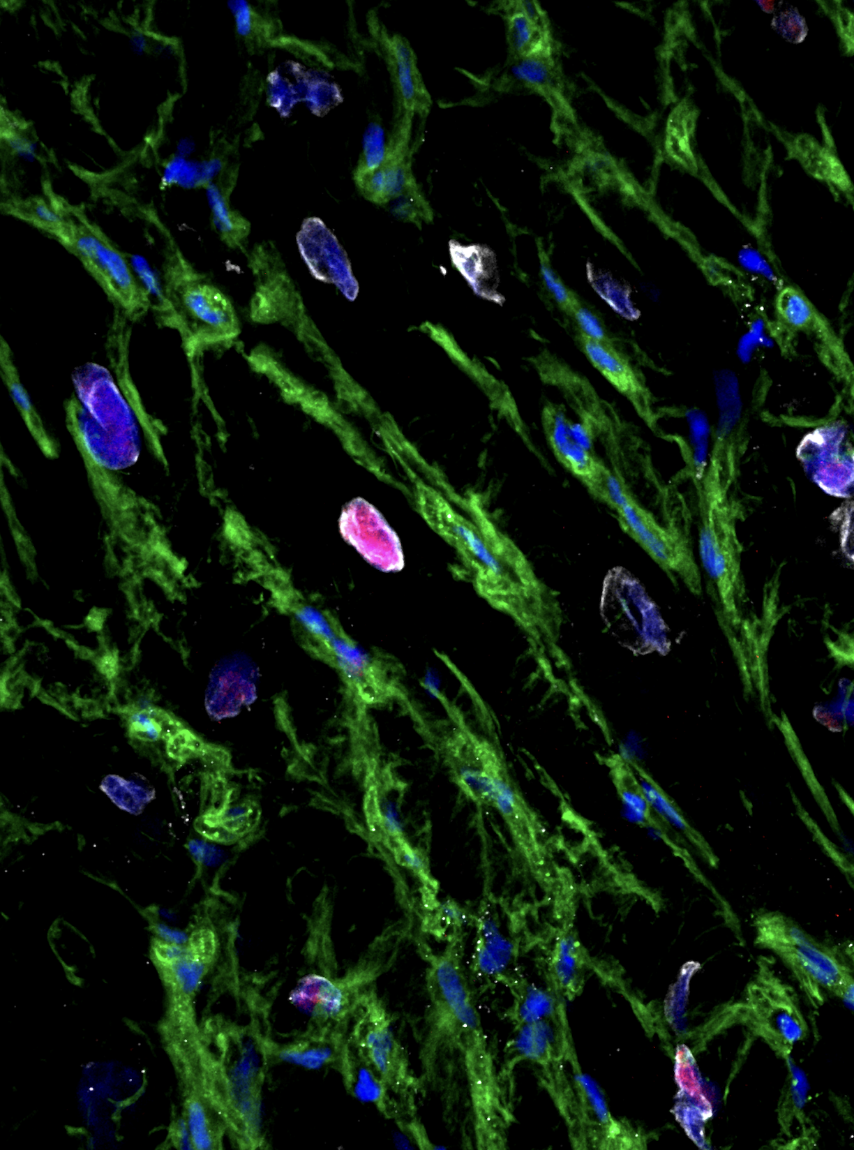 Pink areas shows heart cells replicating. Credit Dr Robert Hume University of Sydney