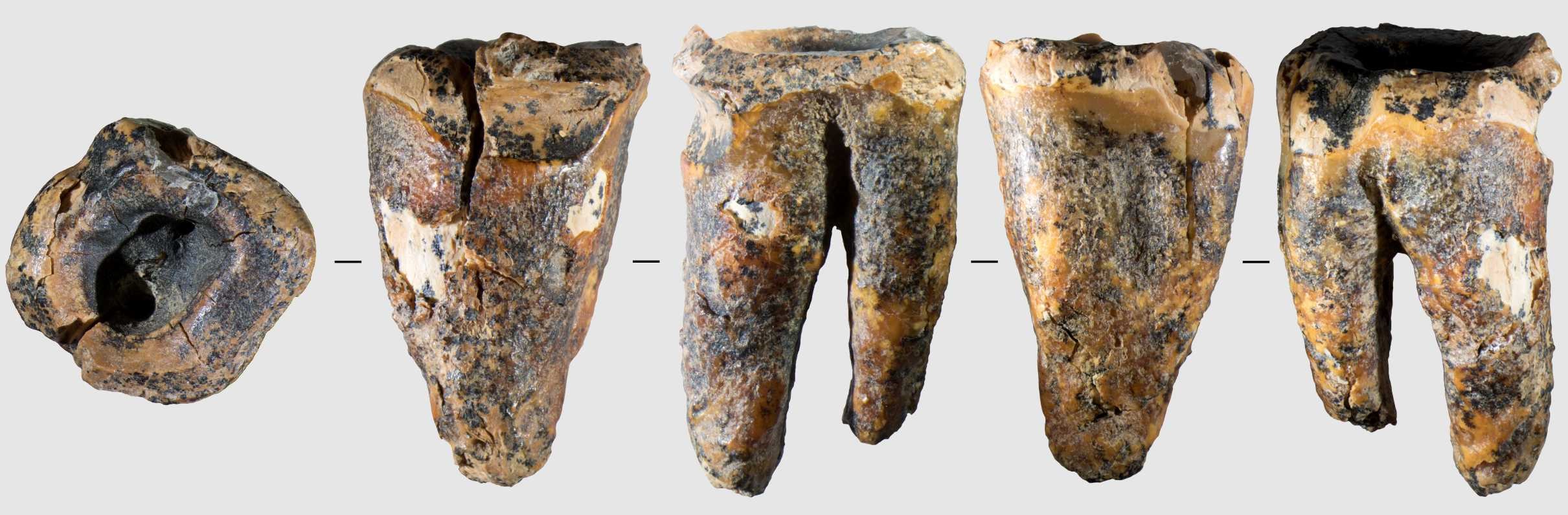 Chagyrskaya 64 molar tooth and its macro-features: General view of the tooth in five projections. Credit: Zubova et al., 2026, PLOS One, CC-BY 4.0 (https://creativecommons.org/licenses/by/4.0/)