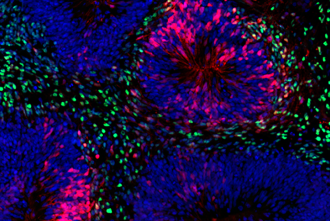 Close-up of a brain organoid