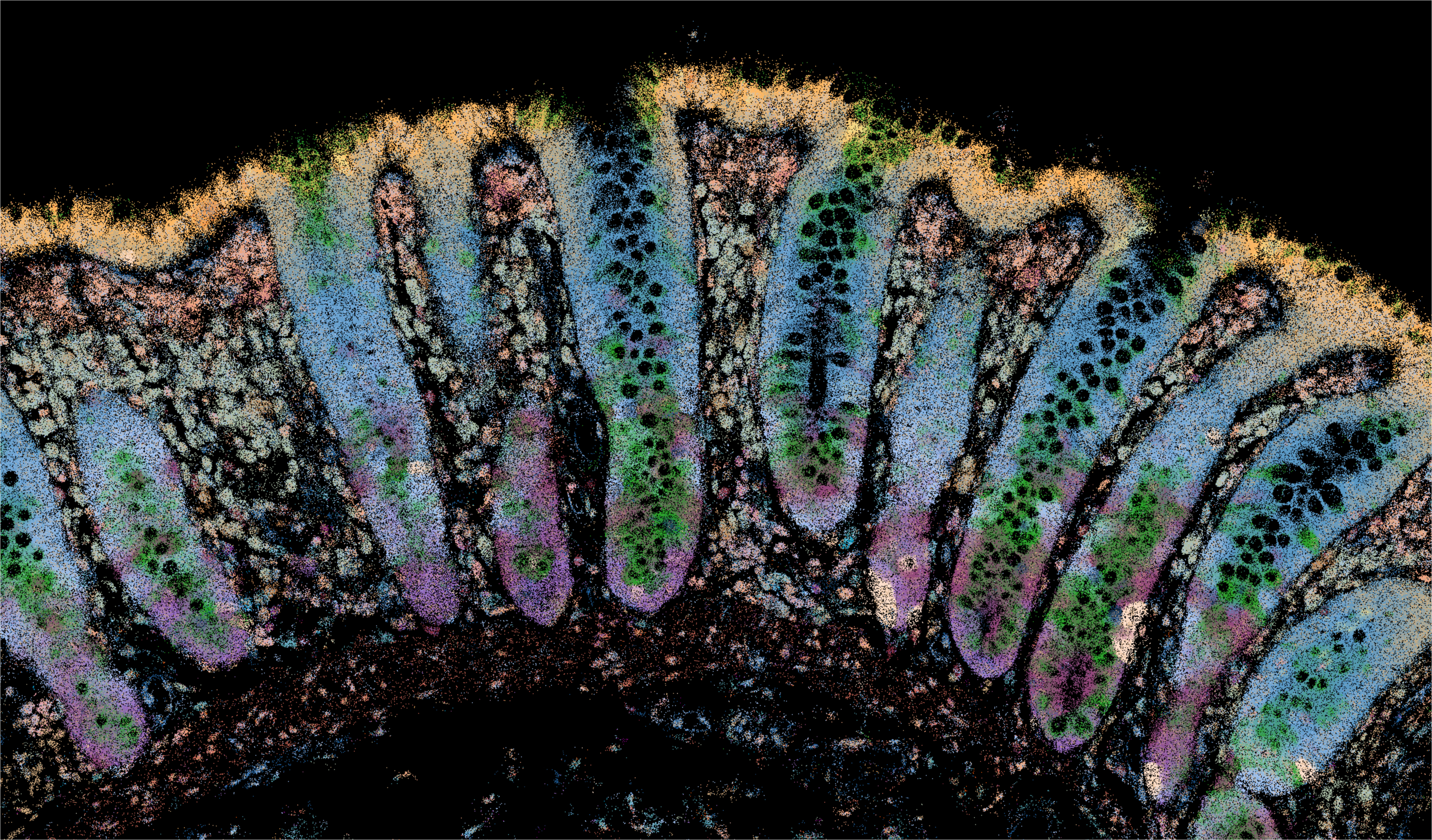 Image taken through spatial transcriptomics showing patterns of cell death-related genes in gut tissue from people with inflammatory bowel disease. Credit: WEHI