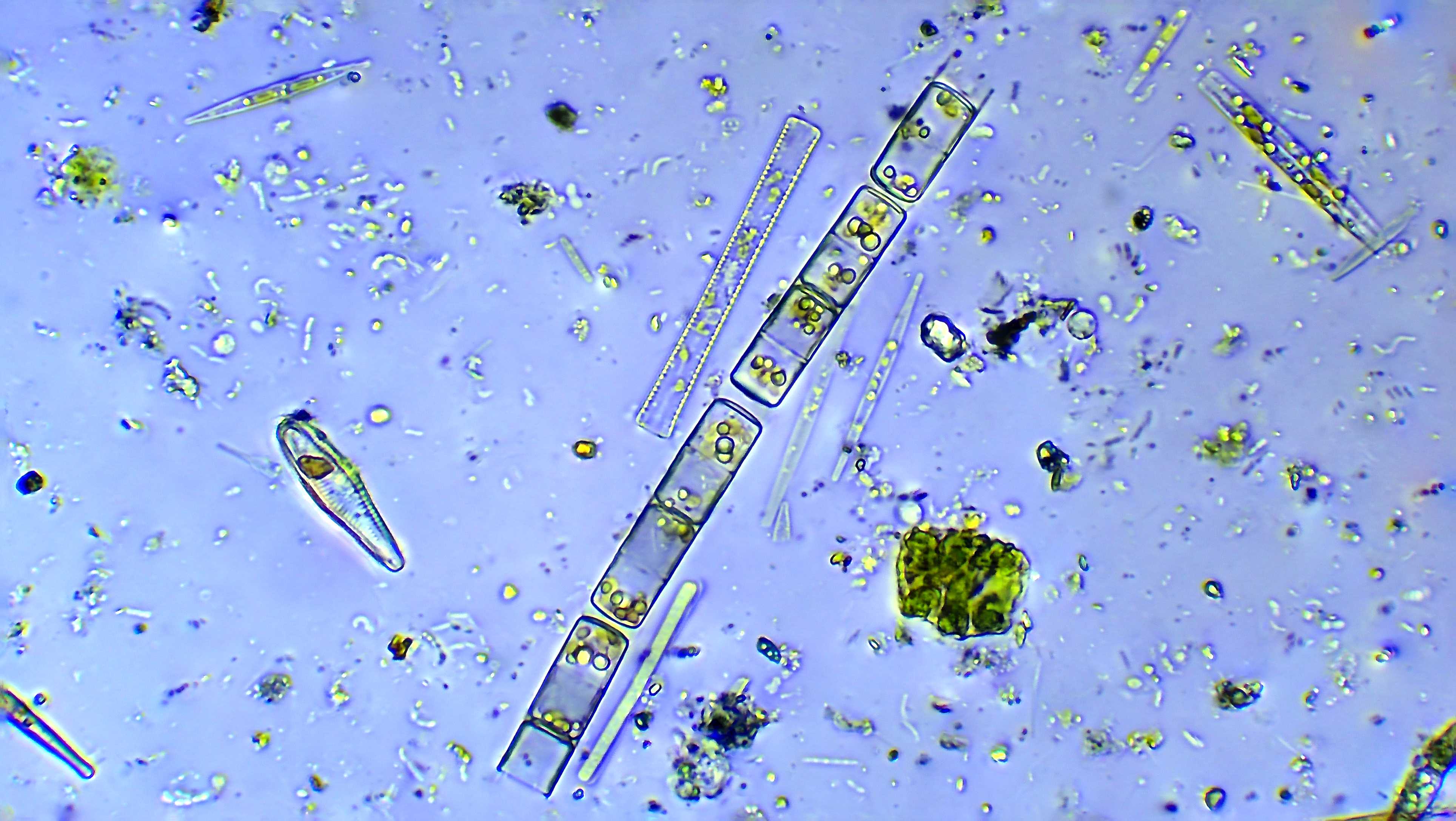 Stock photo of microalgae and diatoms under the microscope. Courtesy Getty Images 