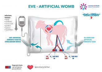 Artificial placenta to support extremely preterm ovine fetuses