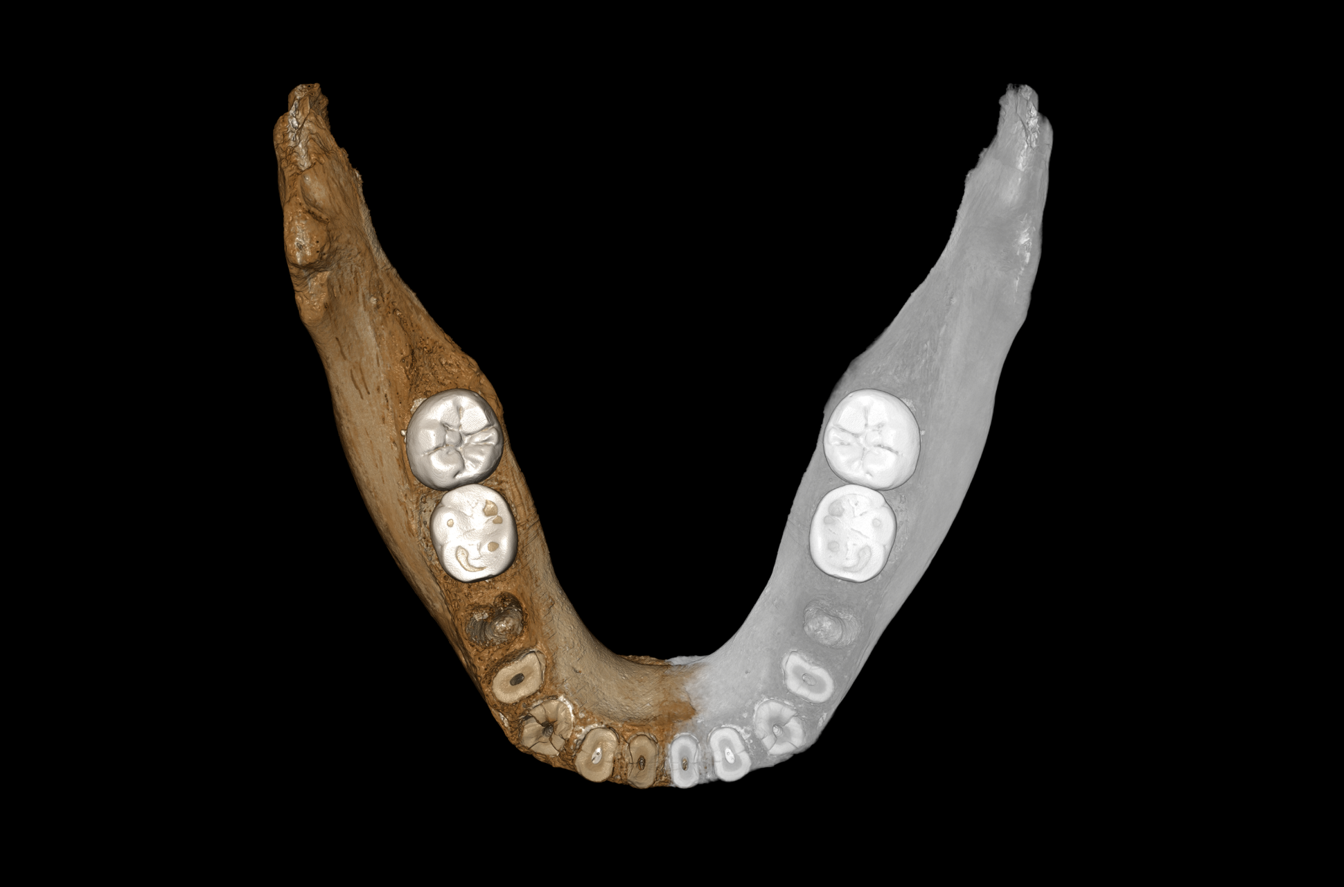 Views of the virtual reconstruction of the Xiahe mandible after digital removal of the adhering carbonate crust. The mandible is so well preserved that it allows for a virtual reconstruction of the two sides of the mandible. Mirrored parts are in grey. (Picture credit: Jean-Jacques Hublin, MPI-EVA, Leipzig)