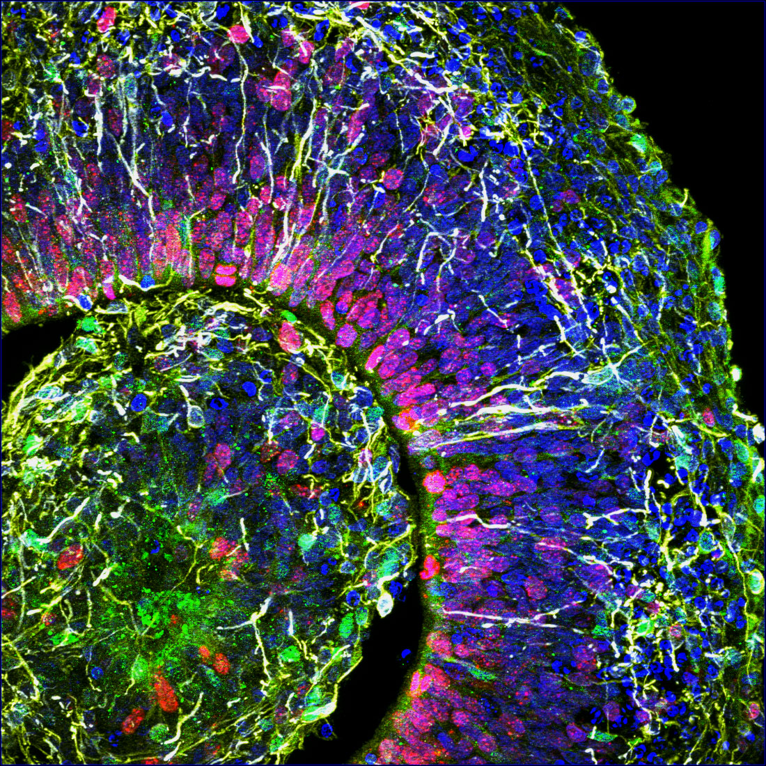 This is a cross-section of a brain organoid, showing the initial formation of a cortical plate. Each colour marks a different type of brain cell. (c) Muotri Lab-UCTV
