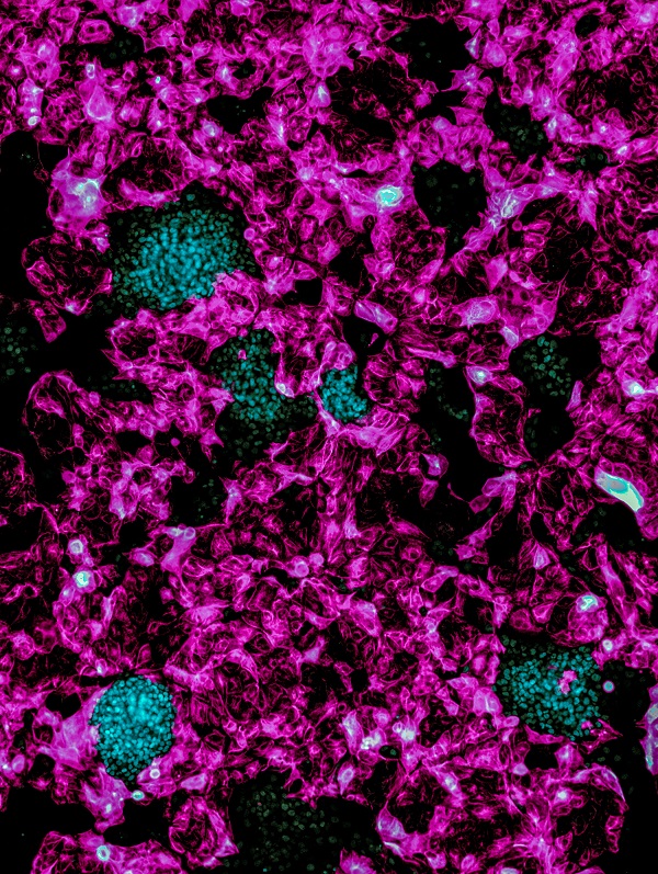 KRT7 positive induced trophoblast stem cells (pink) co-culture with NANOG positive naive induced pluripotent stem cells (cyan). Note how the induced trophoblast stem cells wrap clusters of  naive induced pluripotent stem cells. (C) Monash Biomedicine Discovery Institute
