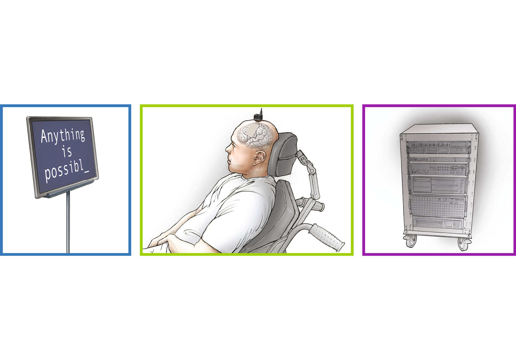 Device that decodes brain activity to spell sentences could help