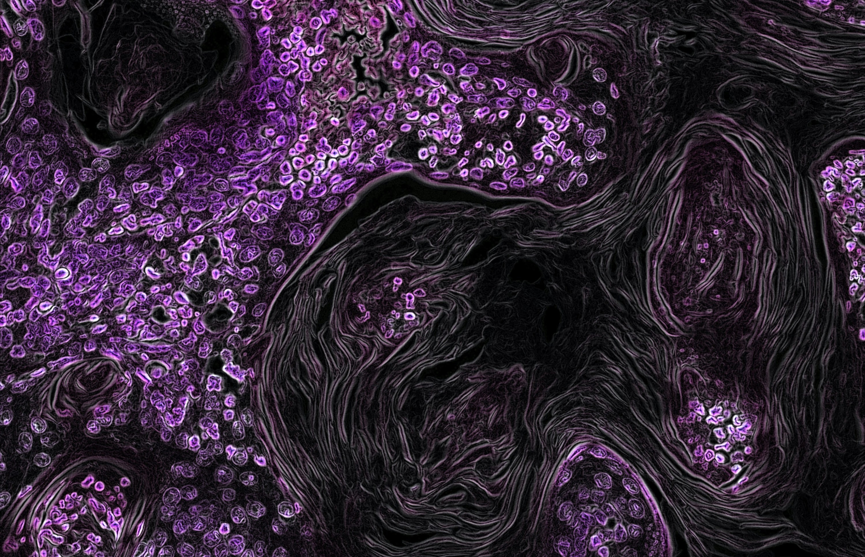 Kras-Driven Lung Cancer. Created by Eric Snyder, 2015. Photo by National Cancer Institute on Unsplash.