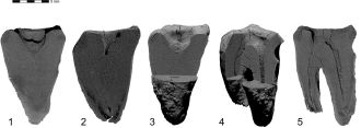 Results of CT-scan of the Chagyrskaya 64 molar.