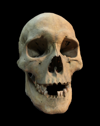 The skull of an adult woman (aged 25-35 years old)